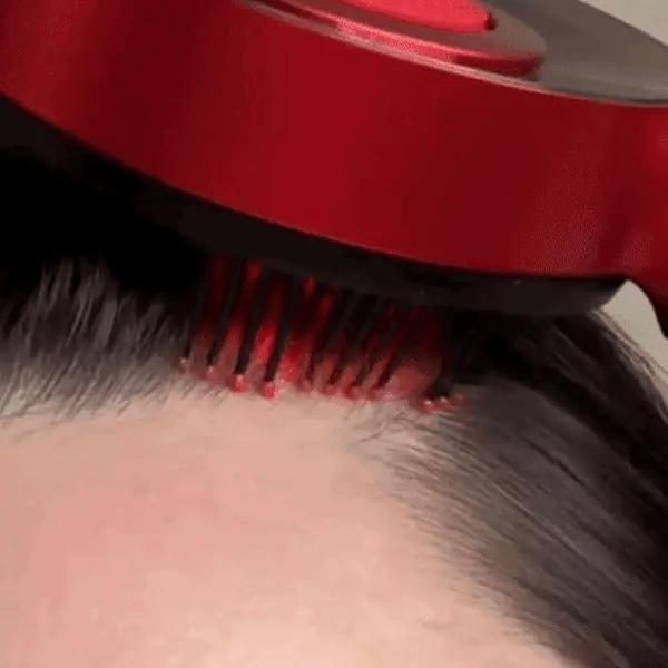 Revitalize Scalp Massager Comb Covers Nepal